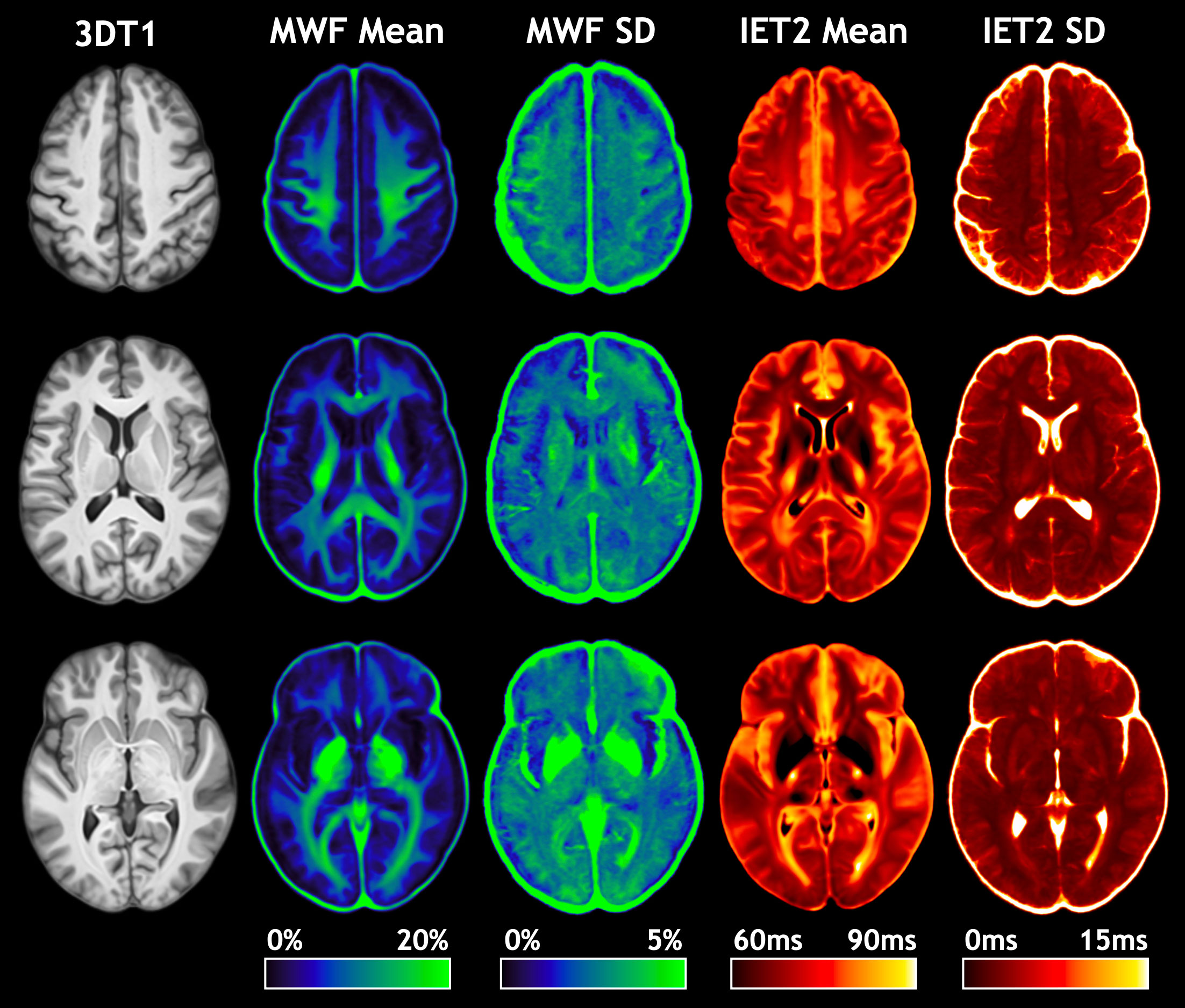 A road map for early brain disease detection - Djavad Mowafaghian ...